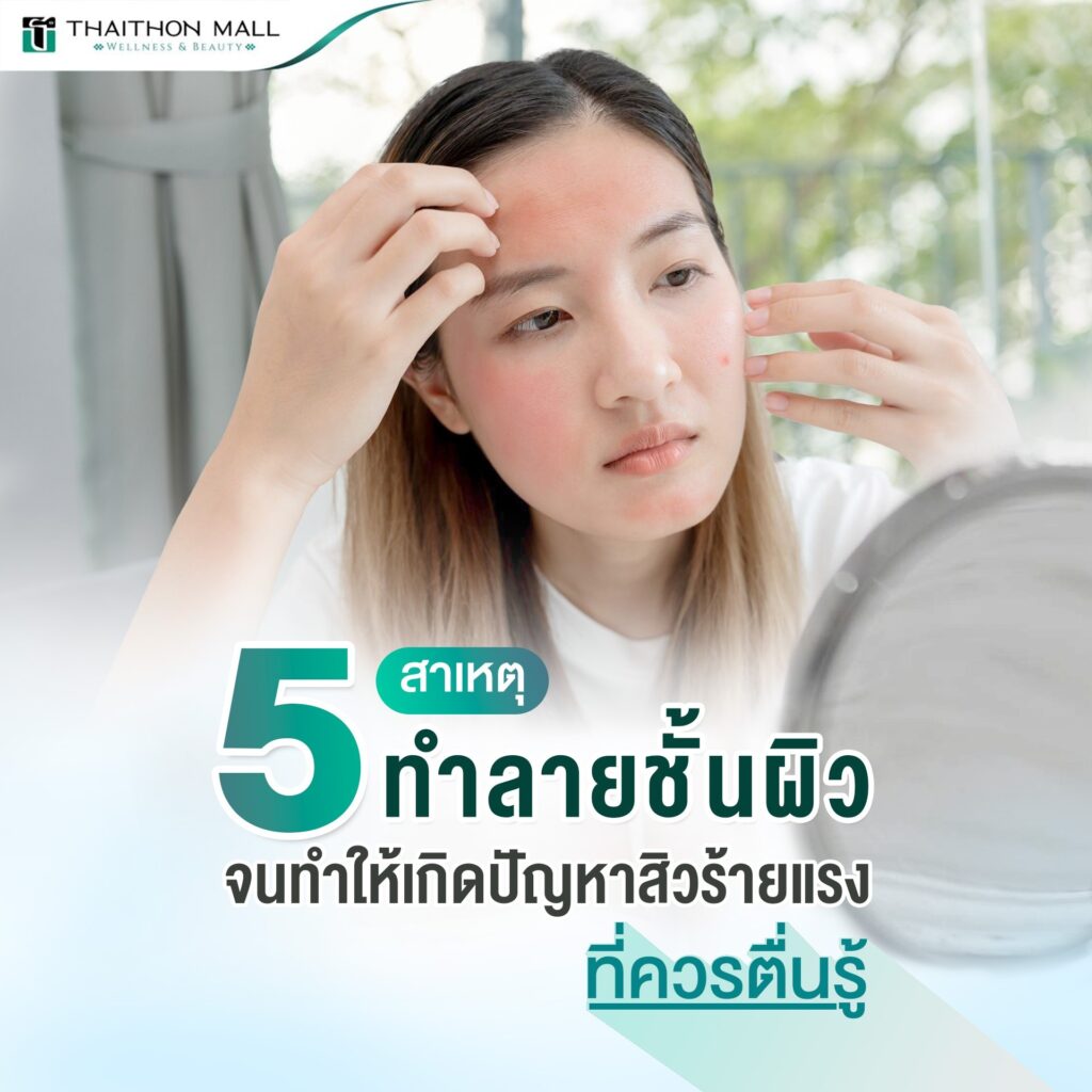 5 สาเหตุ ผิวหน้าเป็นสิว